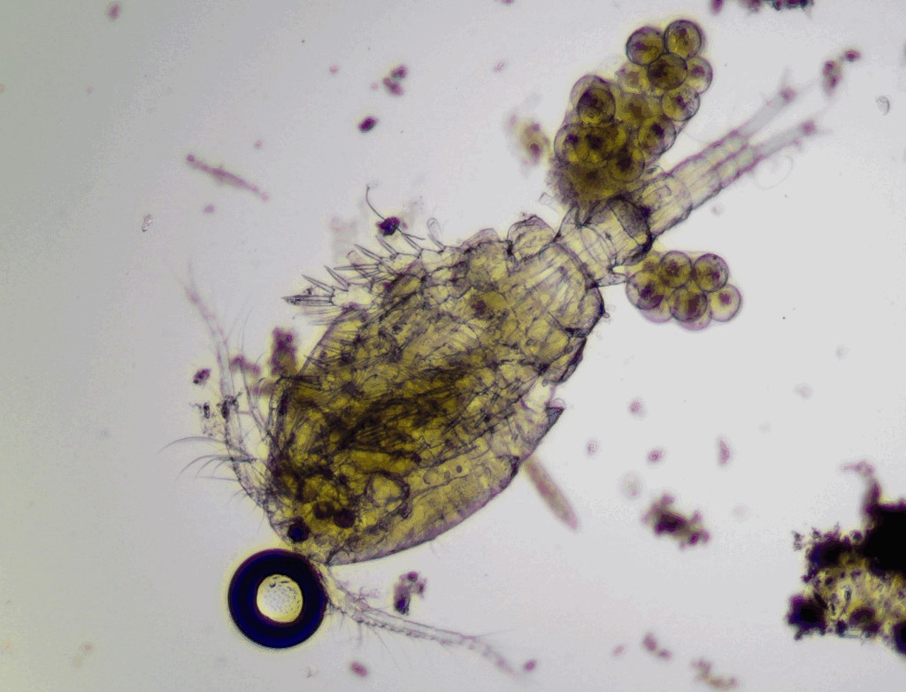 Acanthocyclops_robustus-13.jpg
