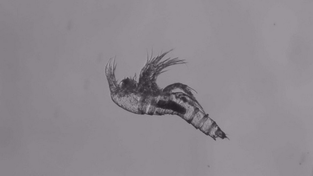 Bryocamptus_minutus-14.jpg