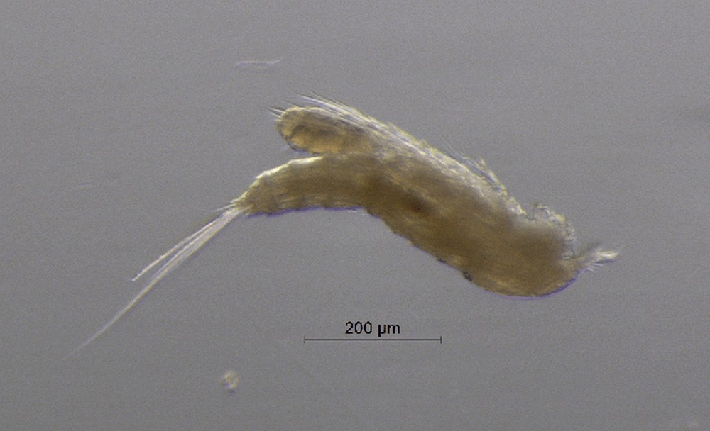 Bryocamptus_pygmaeus-16.jpg