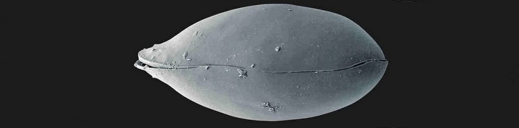 Eucypris_lilljeborgi-R0.jpg