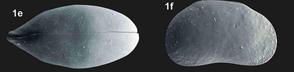 Pseudocandona_pratensis-R1.jpg